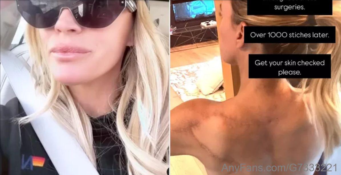 Teddi Mellencamp Cries Tears of Joy After Latest Skin Check Will Not be Biopsied for the First Time in 2 Years